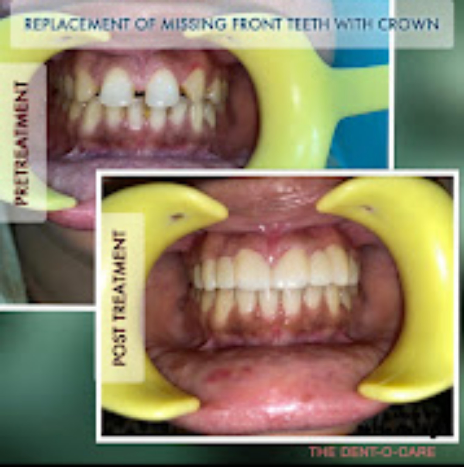 The Dent-O-Care clinical case record 16