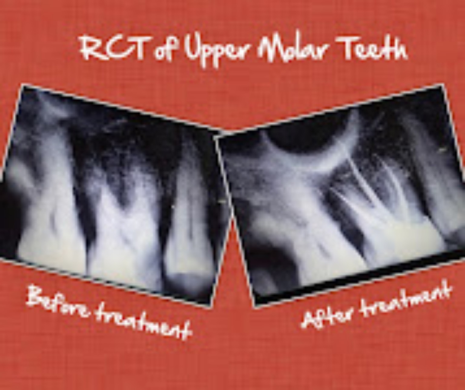 The Dent-O-Care clinical case record 13