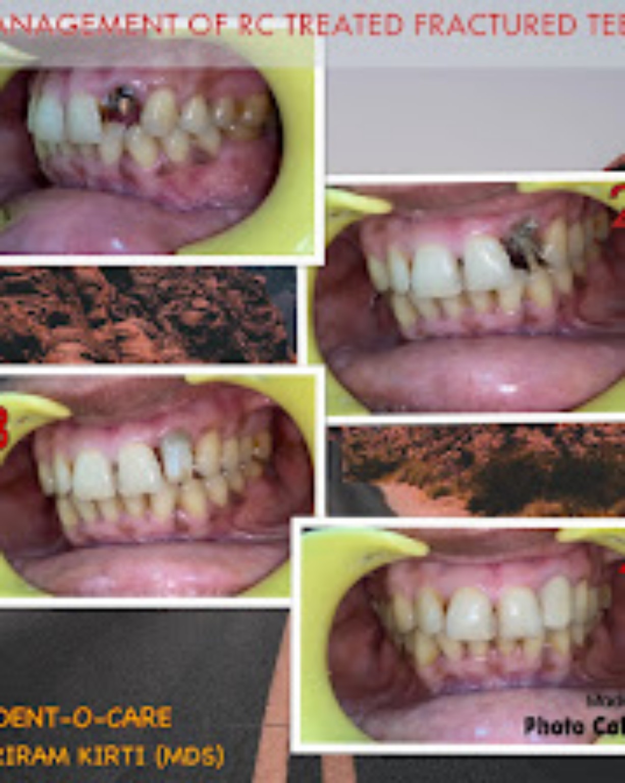 The Dent-O-Care clinical case record 12