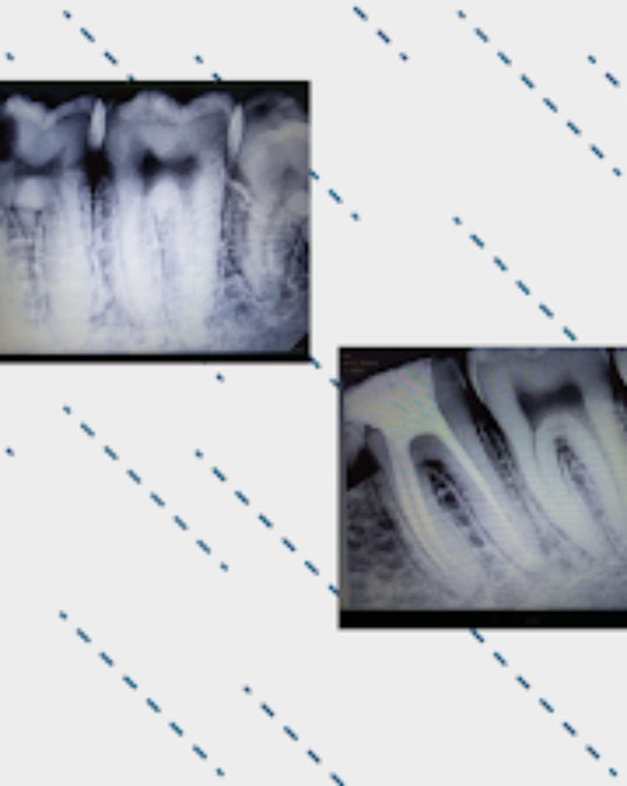 The Dent-O-Care clinical case record 11