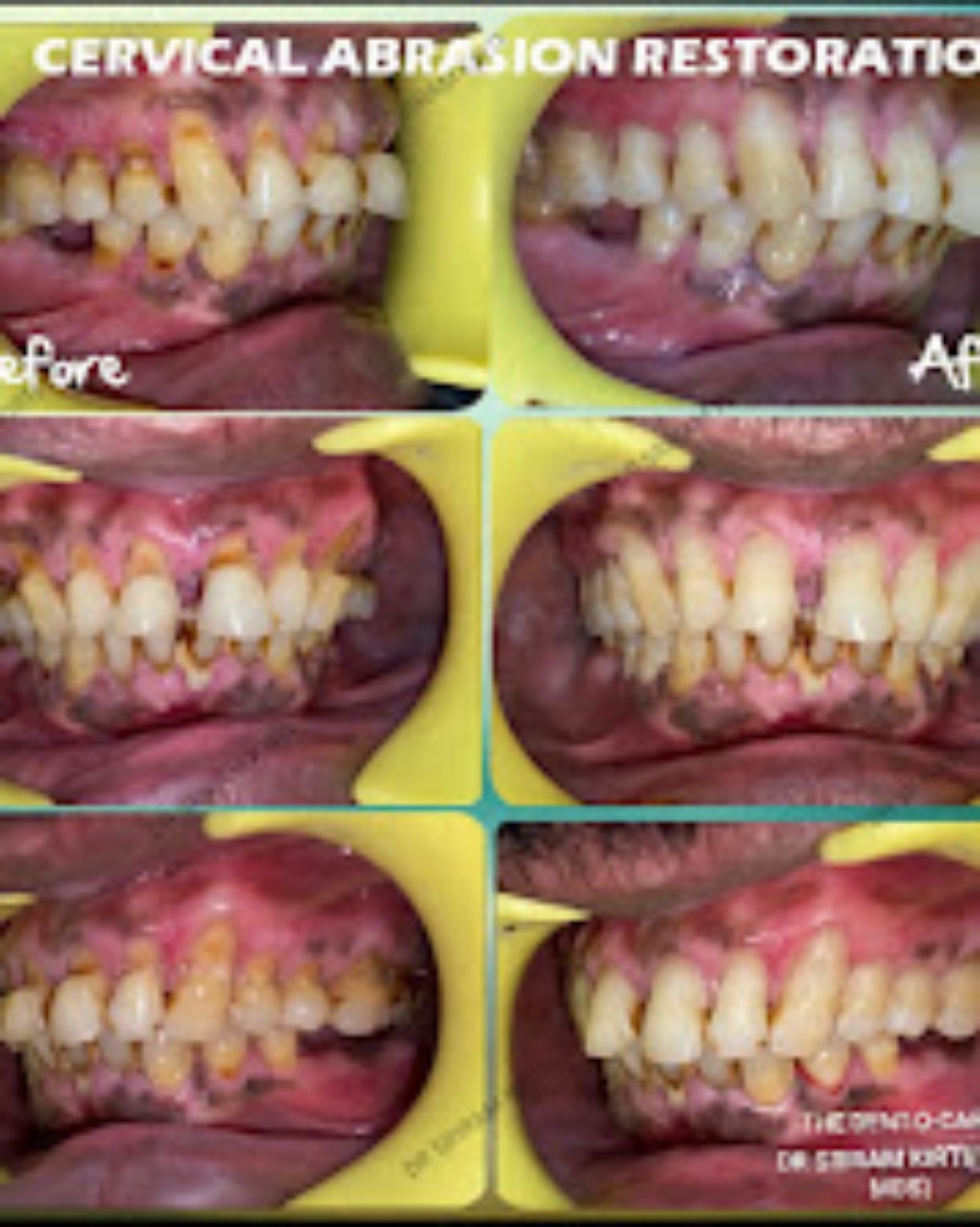 The Dent-O-Care clinical case record 8